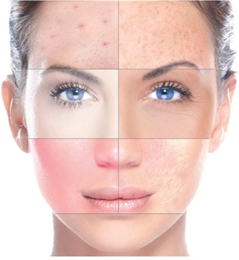 Dry Skin