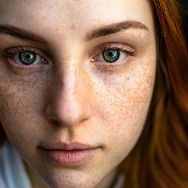 Dark Spots