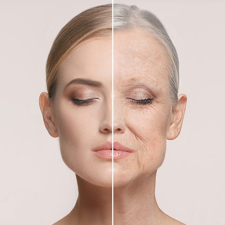 Anti Aging